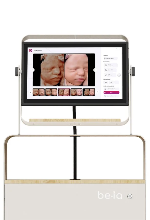 Equipo be·ia con la pantalla mostrando una imagen hiperrealista del bebé